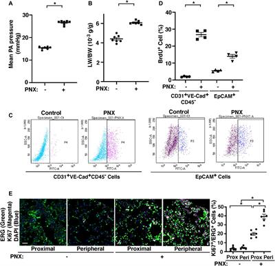 Hydrostatic Pressure Controls Angiogenesis Through Endothelial YAP1 During Lung Regeneration